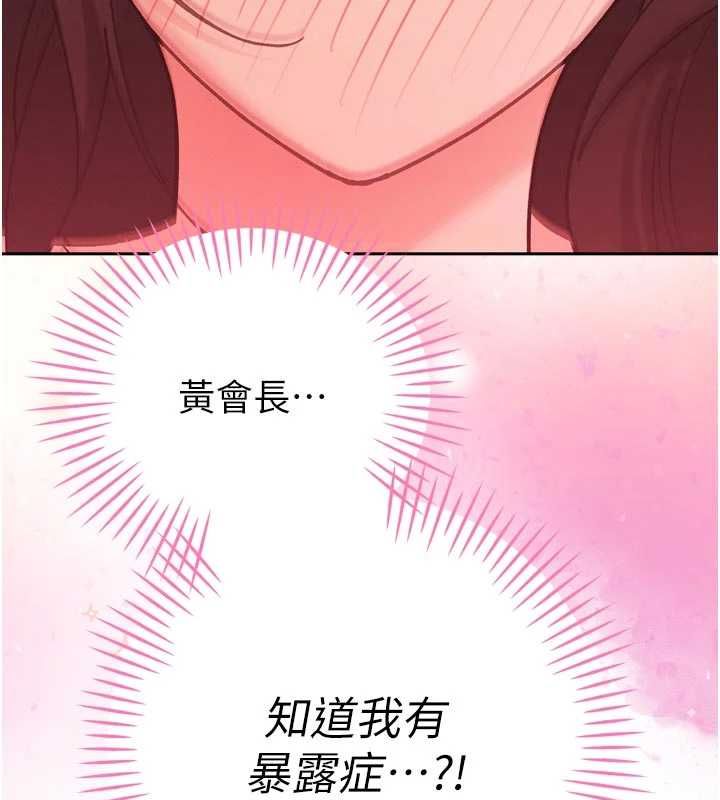 暴君会长的娇媳们第47話-她的暴露症